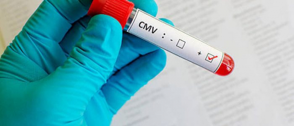 Как проводится анализ на цитомегаловирус